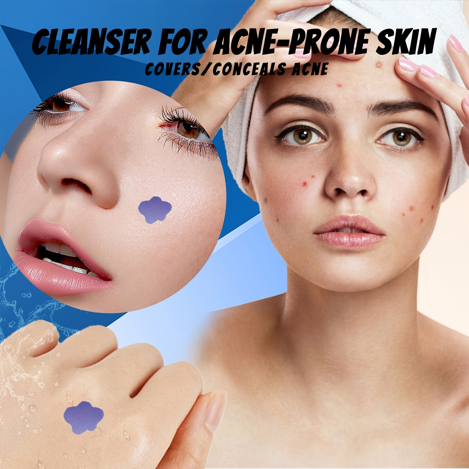 Microneedle Acne Pimple Patch  - Skincare You 评论和价格