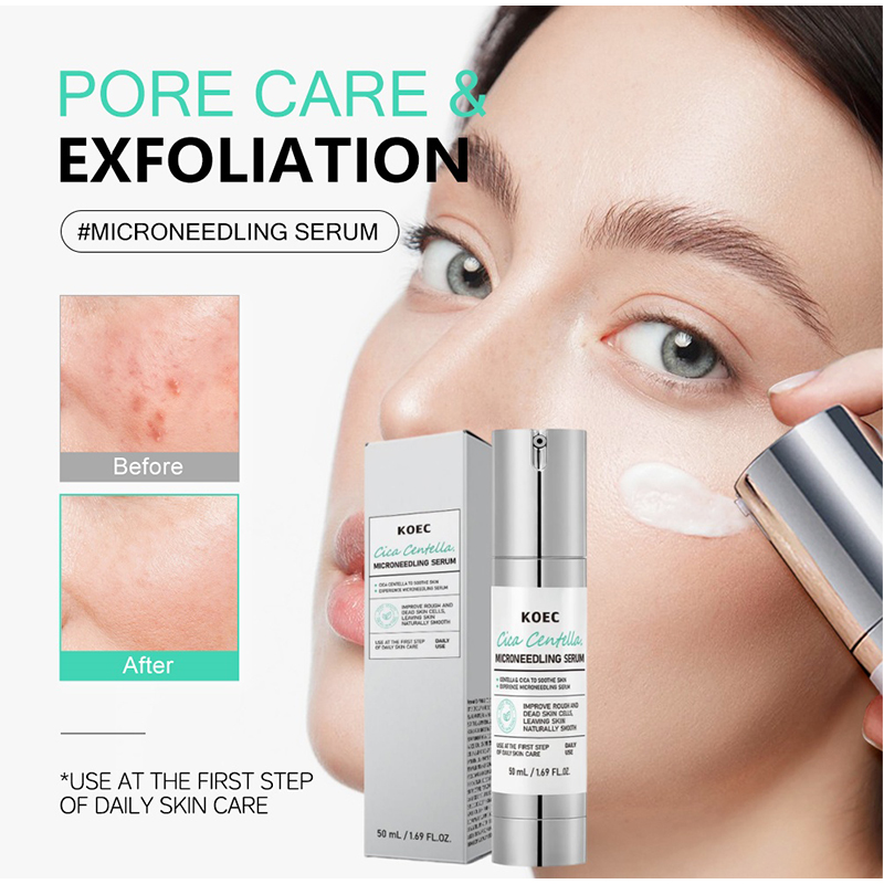 Soothing Microneedle Serum, Ce - Centella Asiatica Toner 评论和价格